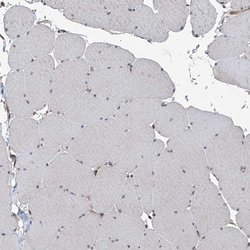 Invitrogen COA7 Polyclonal Antibody 100 &mu;L; Unconjugated:Antibodies,