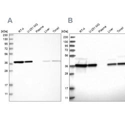 Invitrogen eIF3i Polyclonal Antibody 100 &mu;L; Unconjugated:Antibodies,