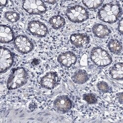 Invitrogen C21orf63 Polyclonal Antibody 100 &mu;L; Unconjugated:Antibodies,