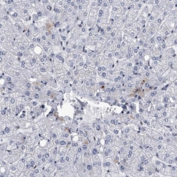 Invitrogen FTSJD2 Polyclonal Antibody 100 &mu;L; Unconjugated:Antibodies,