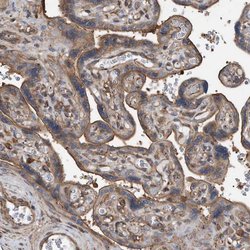 Invitrogen RSPO3 Polyclonal Antibody 100 &mu;L; Unconjugated:Antibodies,