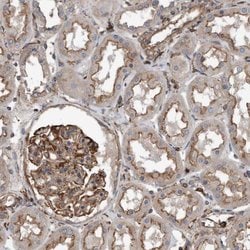 Invitrogen RSPO3 Polyclonal Antibody 100 &mu;L; Unconjugated:Antibodies,