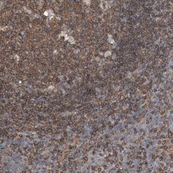 Invitrogen RSPO3 Polyclonal Antibody 100 &mu;L; Unconjugated:Antibodies,
