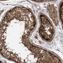 Invitrogen REPS1 Polyclonal Antibody 100 &mu;L; Unconjugated:Antibodies,