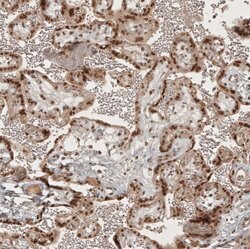Invitrogen RECQL5 Polyclonal Antibody 100 &mu;L; Unconjugated:Antibodies,