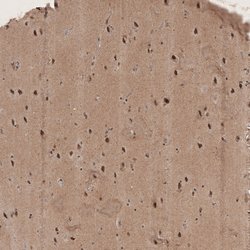 Invitrogen RECQL5 Polyclonal Antibody 100 &mu;L; Unconjugated:Antibodies,