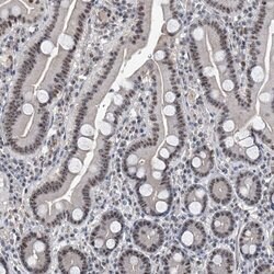 Invitrogen FTSJD2 Polyclonal Antibody 100 &mu;L | Buy Online | Invitrogen&trade; | Fisher Scientific