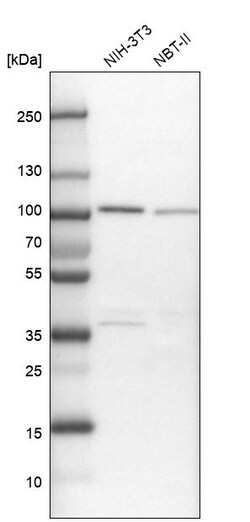 Invitrogen FTSJD2 Polyclonal Antibody 100 &mu;L | Buy Online | Invitrogen&trade; | Fisher Scientific