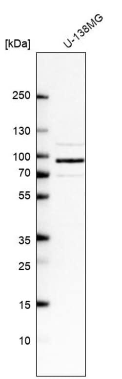 Invitrogen FTSJD2 Polyclonal Antibody 100 &mu;L | Buy Online | Invitrogen&trade; | Fisher Scientific