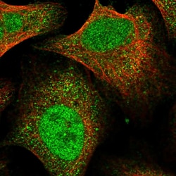 Invitrogen FTSJD2 Polyclonal Antibody 100 &mu;L; Unconjugated:Antibodies,