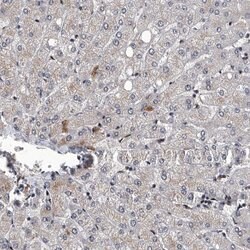 Invitrogen FTSJD2 Polyclonal Antibody 100 &mu;L; Unconjugated:Antibodies,