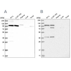 Invitrogen FTSJD2 Polyclonal Antibody 100 &mu;L; Unconjugated:Antibodies,