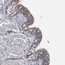 Invitrogen Calpain 13 Polyclonal Antibody 100 &mu;L; Unconjugated:Antibodies,