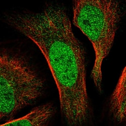 Invitrogen CDCA2 Polyclonal Antibody 100 &mu;L; Unconjugated:Antibodies,