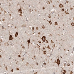 Invitrogen EPRS Polyclonal Antibody 100 &mu;L; Unconjugated:Antibodies,
