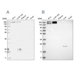 Invitrogen EPRS Polyclonal Antibody 100 &mu;L; Unconjugated:Antibodies,