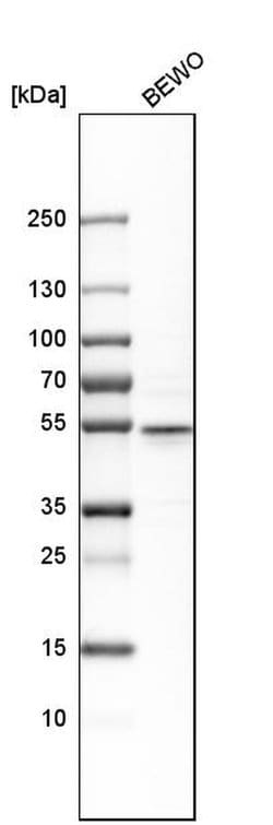 Invitrogen CRISPLD2 Polyclonal Antibody 100 &mu;L; Unconjugated:Antibodies,