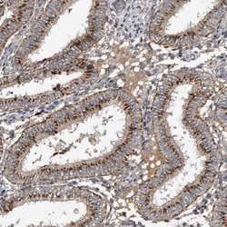 Invitrogen PI15 Polyclonal Antibody 100 &mu;L; Unconjugated:Antibodies,