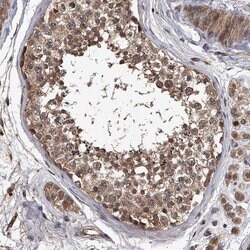 Invitrogen STK36 Polyclonal Antibody 100 &mu;L; Unconjugated:Antibodies,