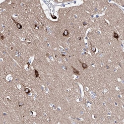 Invitrogen LURAP1 Polyclonal Antibody 100 &mu;L; Unconjugated:Antibodies,