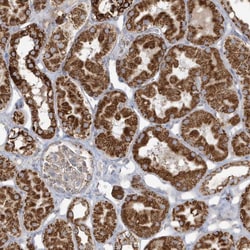 Invitrogen RAB11FIP3 Polyclonal Antibody 100 &mu;L; Unconjugated:Antibodies,