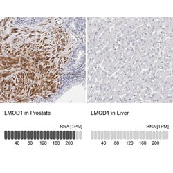 Invitrogen LMOD1 Polyclonal Antibody 100 &mu;L; Unconjugated:Antibodies,