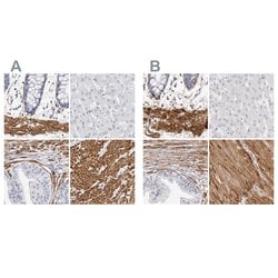 Invitrogen LMOD1 Polyclonal Antibody 100 &mu;L; Unconjugated:Antibodies,