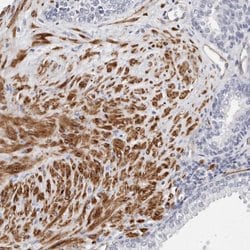 Invitrogen LMOD1 Polyclonal Antibody 100 &mu;L; Unconjugated:Antibodies,