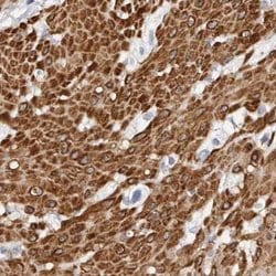Invitrogen LMOD1 Polyclonal Antibody 100 &mu;L; Unconjugated:Antibodies,