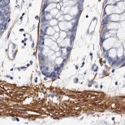 Invitrogen LMOD1 Polyclonal Antibody 100 &mu;L; Unconjugated:Antibodies,