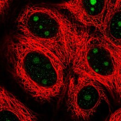 Invitrogen SPATA17 Polyclonal Antibody 100 &mu;L; Unconjugated:Antibodies,