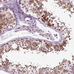 Invitrogen SPATA17 Polyclonal Antibody 100 &mu;L; Unconjugated:Antibodies,