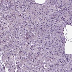 Invitrogen SPATA17 Polyclonal Antibody 100 &mu;L; Unconjugated:Antibodies,
