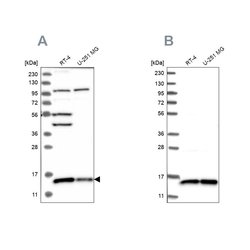Invitrogen FAM136A Polyclonal Antibody 100 &mu;L; Unconjugated:Antibodies,