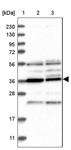Invitrogen PAK1IP1 Polyclonal Antibody 100 &mu;L | Buy Online | Invitrogen&trade; | Fisher Scientific