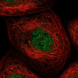Invitrogen KLDC3 Polyclonal Antibody 100 &mu;L; Unconjugated:Antibodies,