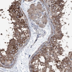 Invitrogen HSPB11 Polyclonal Antibody 100 &mu;L; Unconjugated:Antibodies,