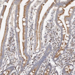 Invitrogen IQGAP3 Polyclonal Antibody 100 &mu;L | Buy Online | Invitrogen&trade; | Fisher Scientific