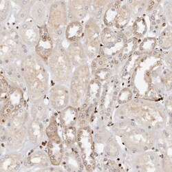 Invitrogen IQGAP3 Polyclonal Antibody 100 &mu;L | Buy Online | Invitrogen&trade; | Fisher Scientific