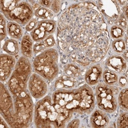 Invitrogen PKIB Polyclonal Antibody 100 &mu;L; Unconjugated:Antibodies,