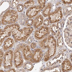 Invitrogen LTV1 Homolog Polyclonal Antibody 100 &mu;L; Unconjugated:Antibodies,