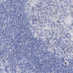 Invitrogen FRS3 Polyclonal Antibody 100 &mu;L | Buy Online | Invitrogen&trade; | Fisher Scientific