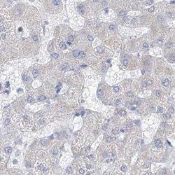 Invitrogen FRS3 Polyclonal Antibody 100 &mu;L | Buy Online | Invitrogen&trade; | Fisher Scientific