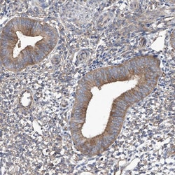 Invitrogen TJAP1 Polyclonal Antibody 100 μL; Unconjugated:Antibodies,