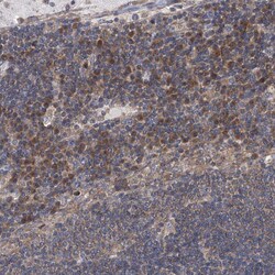 Invitrogen TJAP1 Polyclonal Antibody 100 μL; Unconjugated:Antibodies,