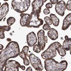 Invitrogen TJAP1 Polyclonal Antibody 100 μL; Unconjugated:Antibodies,