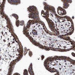 Invitrogen TJAP1 Polyclonal Antibody 100 μL; Unconjugated:Antibodies,