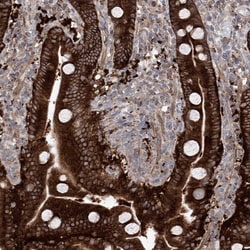 Invitrogen KLC4 Polyclonal Antibody 100 &mu;L; Unconjugated:Antibodies,