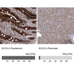 Invitrogen KLC4 Polyclonal Antibody 100 &mu;L; Unconjugated:Antibodies,