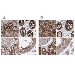 Invitrogen KLC4 Polyclonal Antibody 100 &mu;L; Unconjugated:Antibodies,